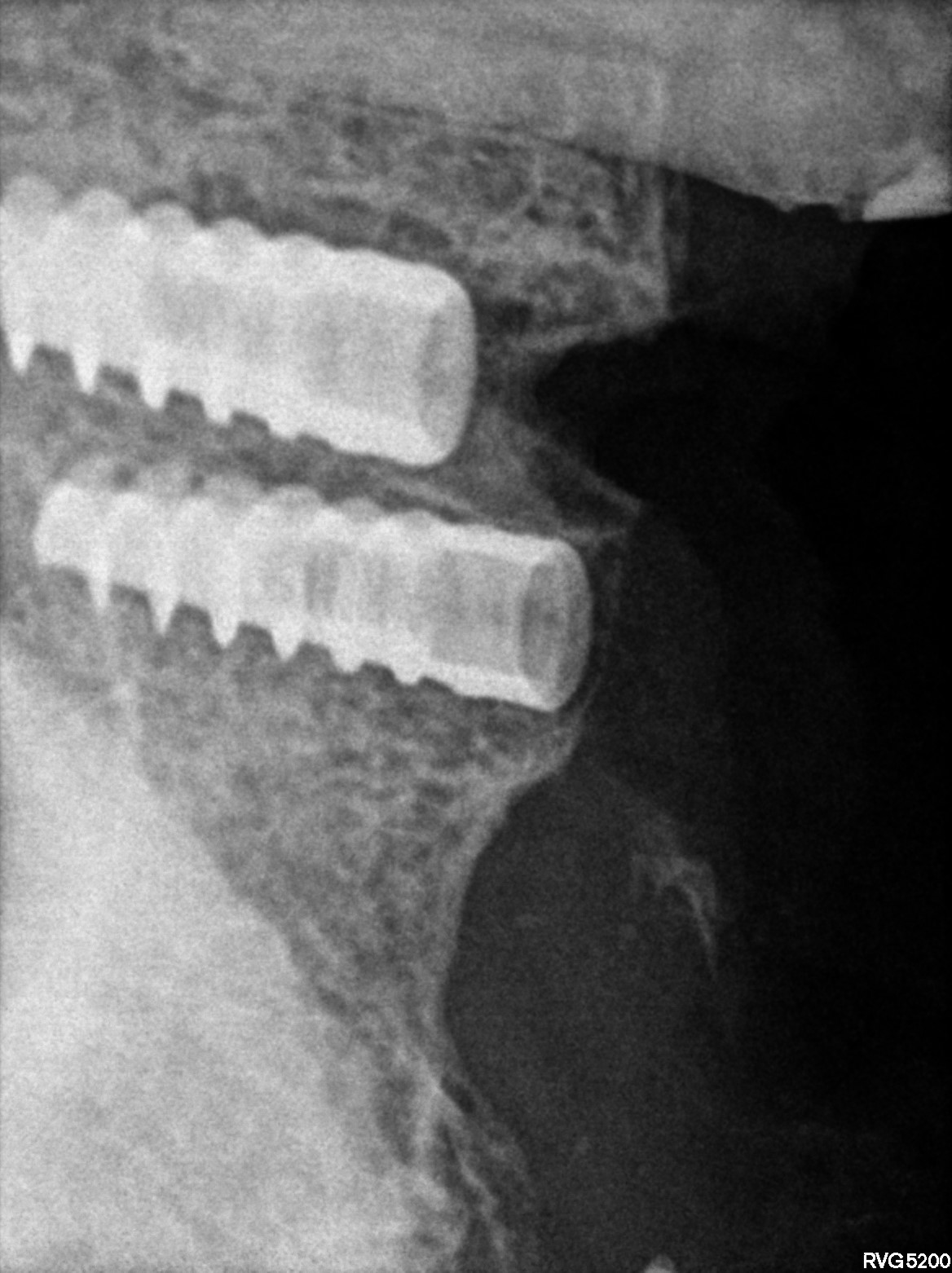 Dental X-ray